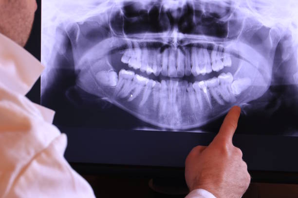 Best After-Hours Dental Trauma Care in Hamlin, WV
