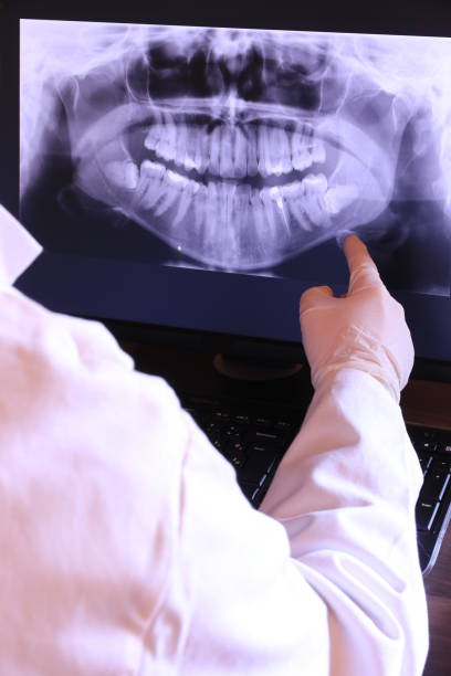 Best Emergency Dental Care for Broken or Chipped Teeth in Hamlin, WV