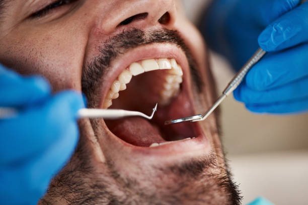Best Urgent Care for Lost Fillings or Crowns in Hamlin, WV